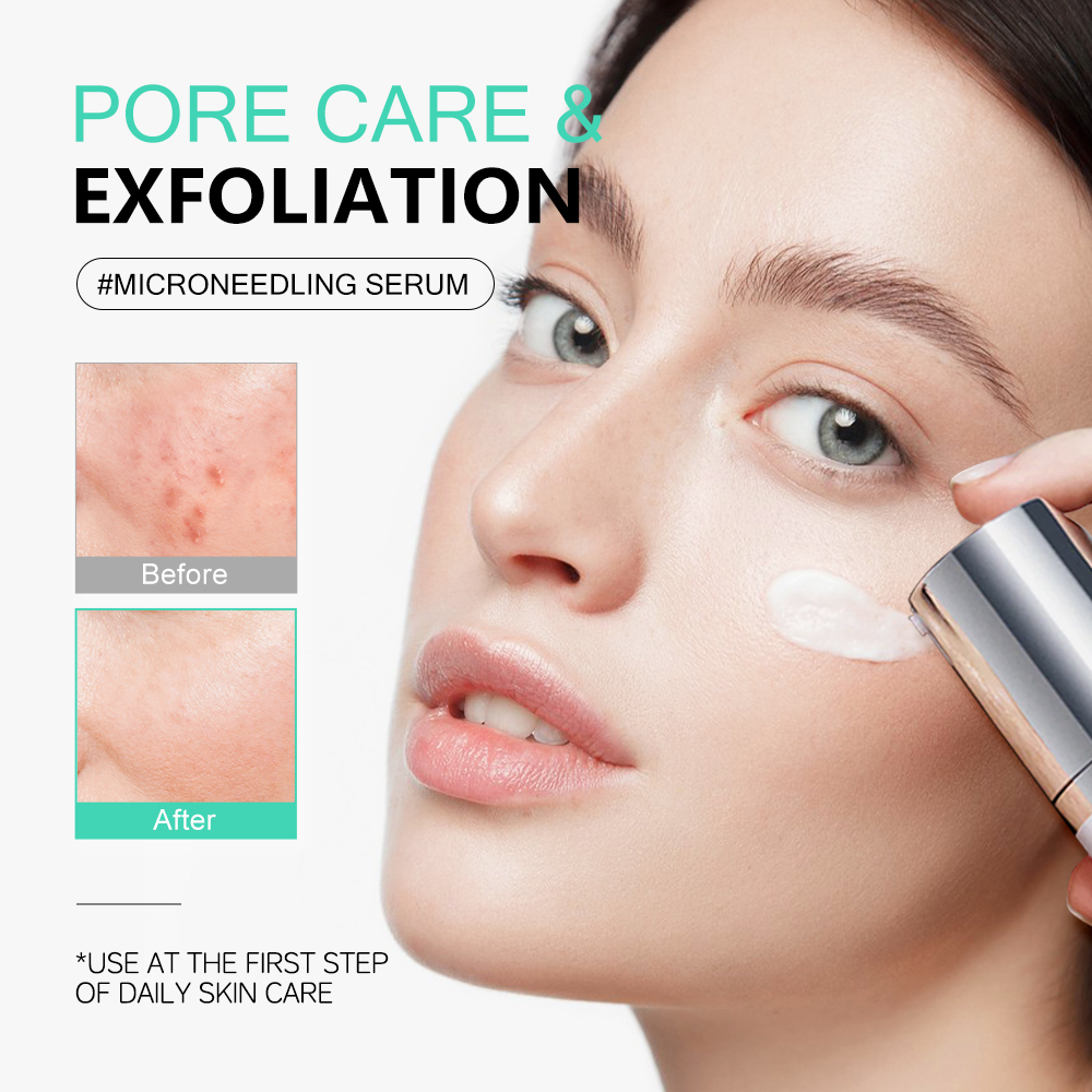 Skincare Centella Asiatica Micro Needle Serum, Anti-Inflammatory & Soothing Formula, for Sensitive Skin & Acne-Prone Areas