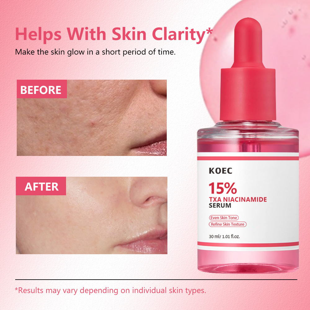 15% Niacinamide Facial Serum, Moisturizing Facial Care Essence, Hydrating Facial Skin Care Product for Women & Men