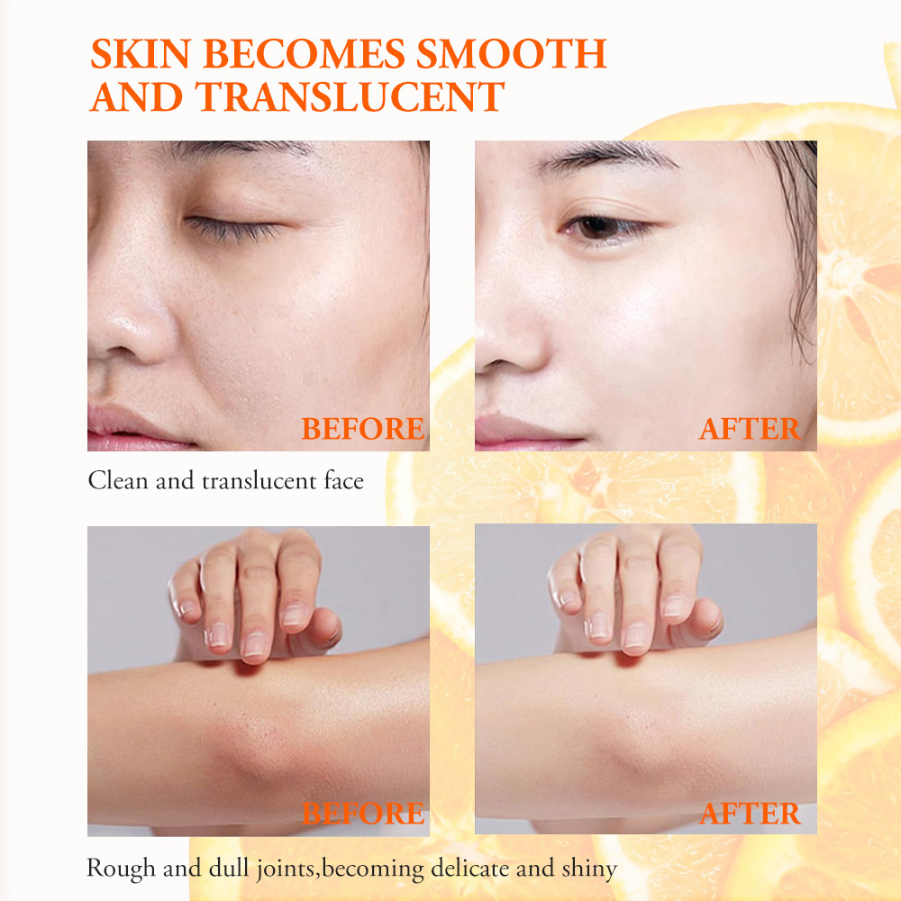 Vitamin C Exfoliating Gel for Radiant Skin, Deep Cleansing and Hydrating Formula, Gentle Peeling for Smooth Complexion