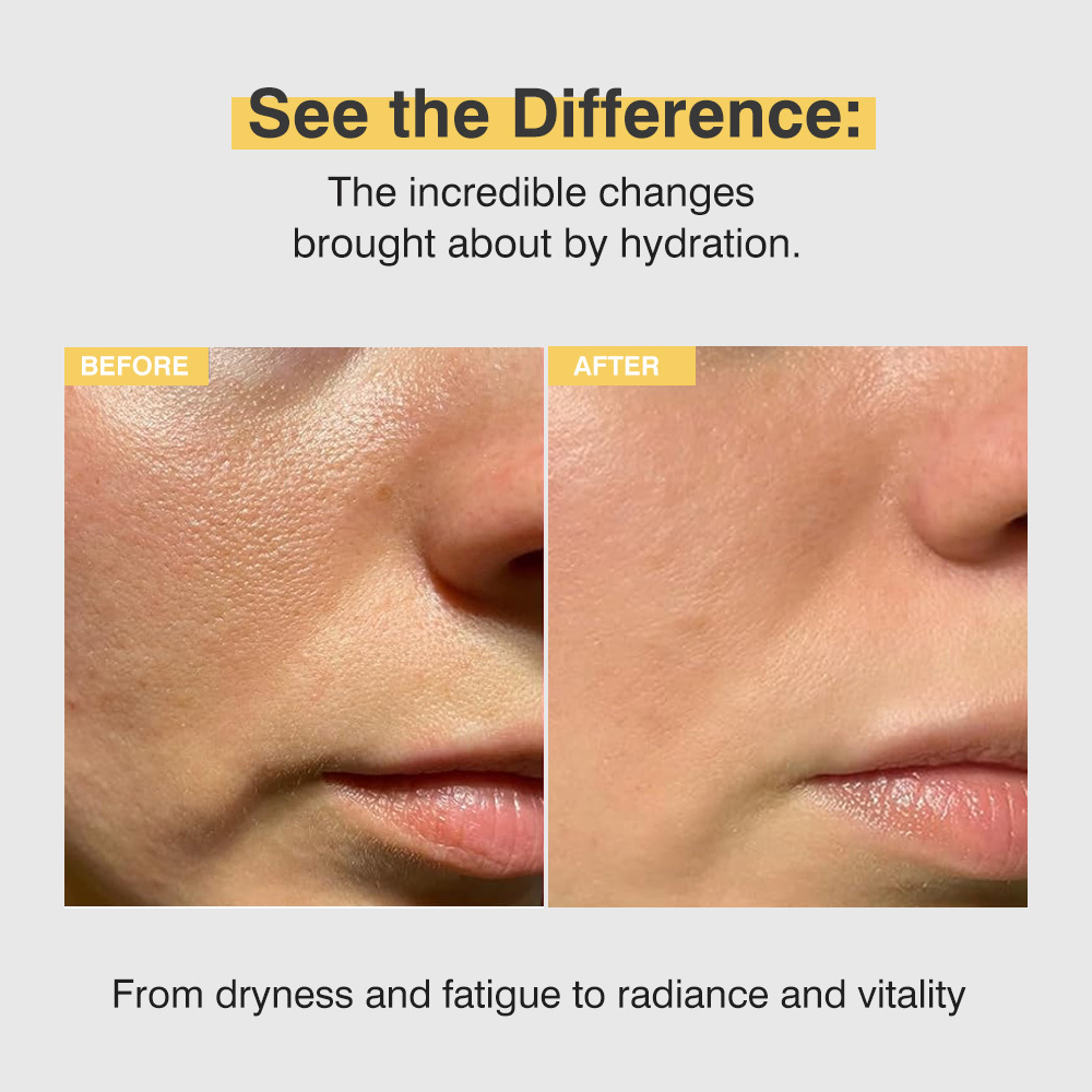 Deep Moisturizing Collagen Boosting Face Serum, Hydrating Facial Essence,  Face Firming Serum, Skin Care Product for Women & Men