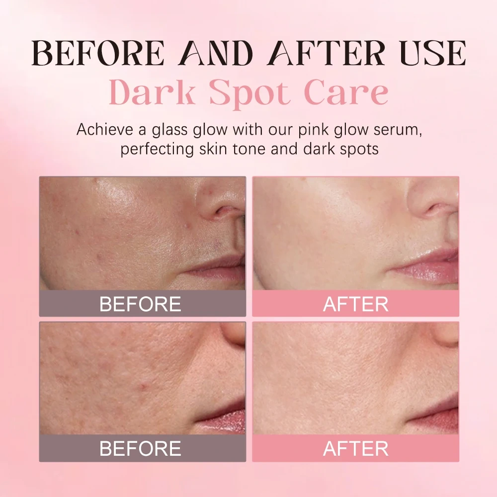 Rose Pdrn Pink Peptide Serum 30ml KOEC Private Label Niacinadmie Hydrating Moisturizing PDRN Face Serum Brightening Skin OEM