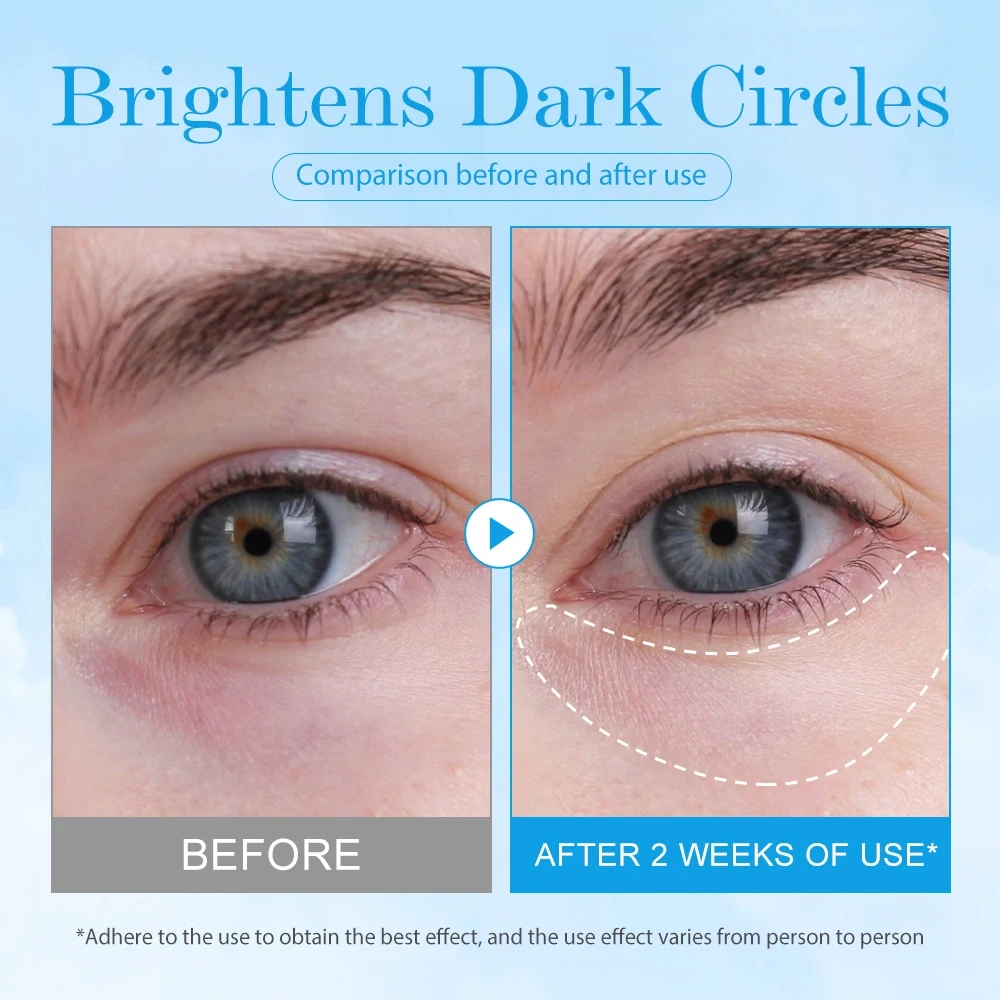 Bomb Cooling Eye Gel Caffeine Hyaluronic Acid for Puffiness Hydration Niacinamide  for Dark Circles Plumping Firming Eye Care