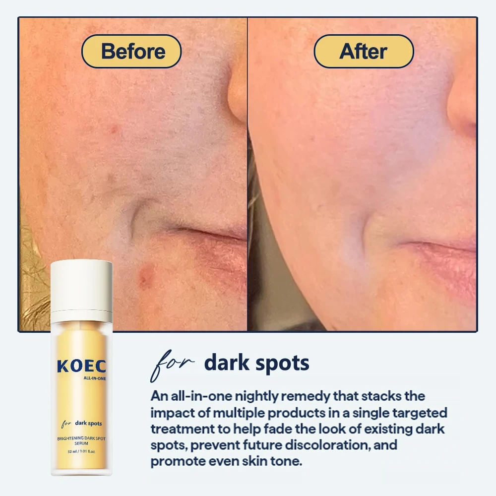 KOEC Brightening Dark Spot Serum Stack Impact Treat Fade Existing Dark Spot Prevent Discoloration Accept Customize Private Label