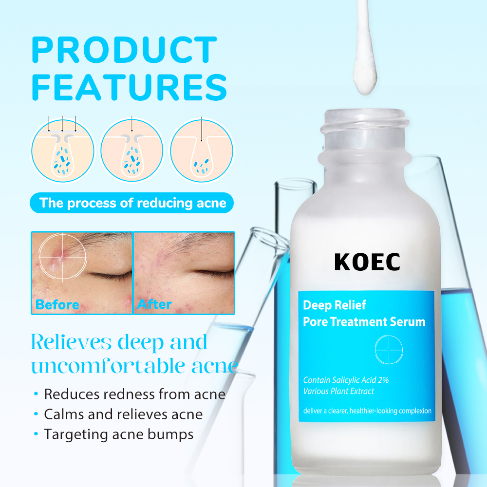 Deep Relief Pore Treatment Serum KOEC Powerful Phytosteroid Treatment Heals Deep Uncomfortable Acne Accept Custom Private Logo