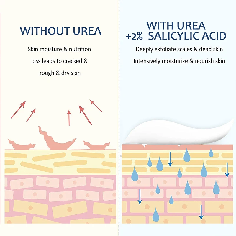 40% Urea Repair Foot Cream
