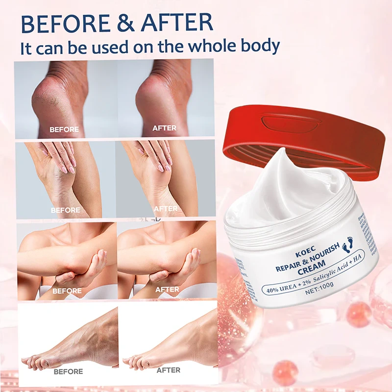 40% Urea Repair Foot Cream