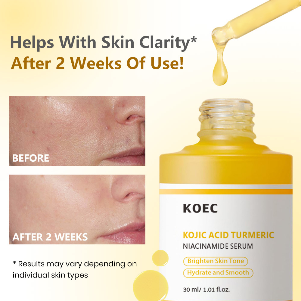 Kojic Acid Turmeric Brightening Capsule Face Serum 30ml