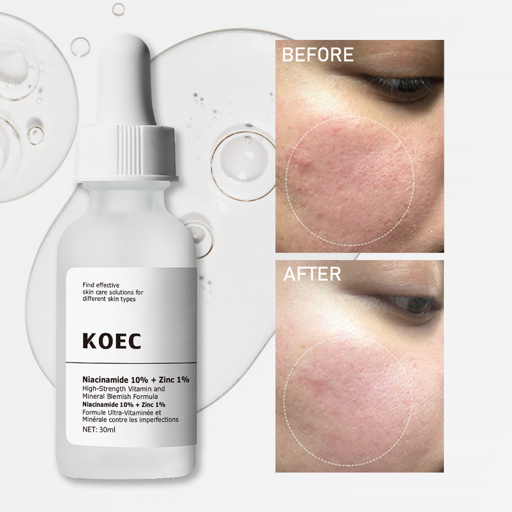 Natural Facial Serum Set Wholesale, KOEC HA , Caffeine , AHA, Salicylic Acid, Retinol, Niacinamide Korean Face Serum Solution