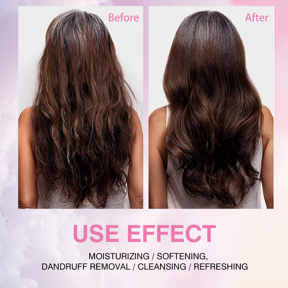 Hair Care DUO Box Shampoo Onion Biotin and Rosemary Shampoo Stronger Thicker and Longer Hair Soft Shine Hair Loss Accept OEM