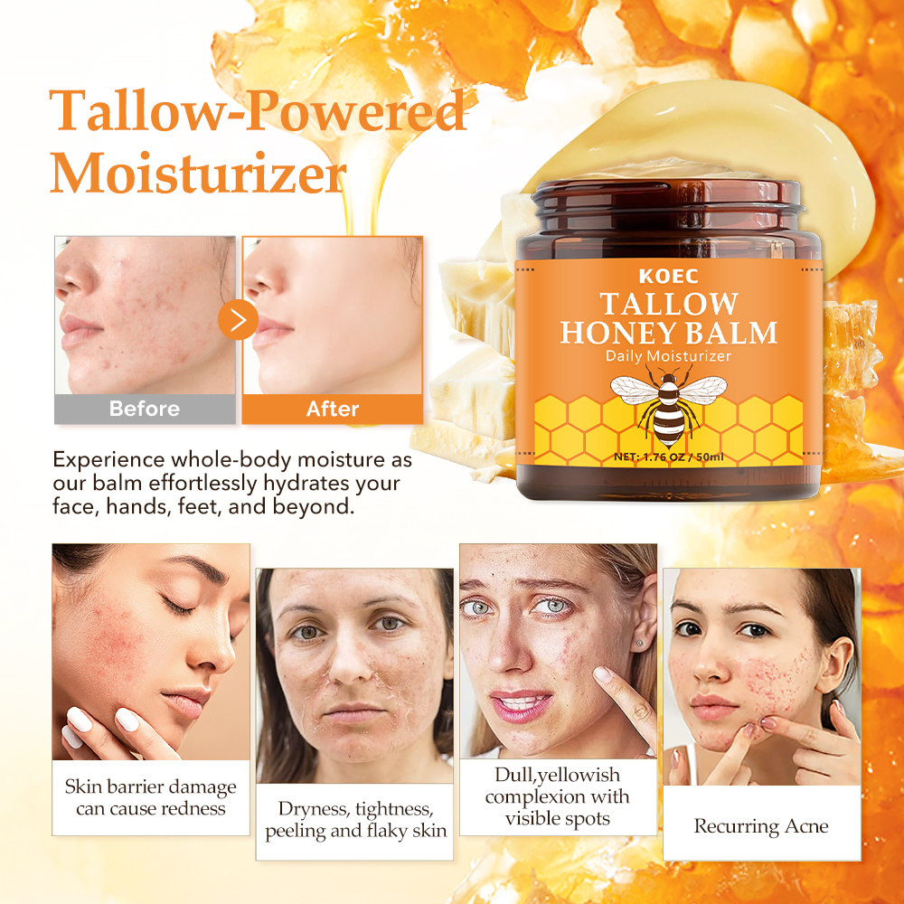 Koec High Quality Honey Beef Tallow Balm Moisturizer Natural Honey Tallow Night Cream for Smooth Skin  Moisturizing Cream