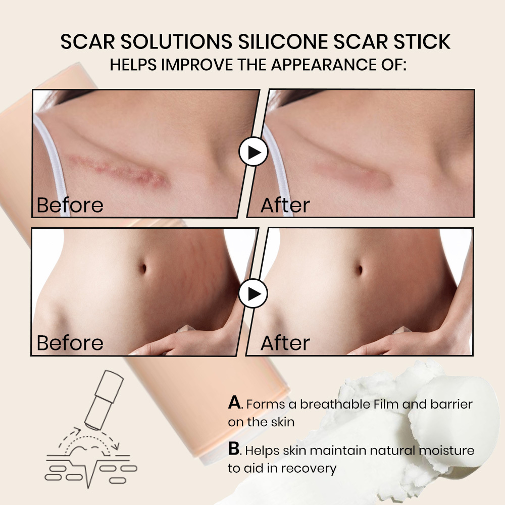 Silicone Scar Stick for Face and Body with Centella Asiatica Vitamin E Soothing Moisturizing Scar Treatment for Old New Scar OEM