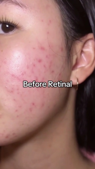 Brightening Dark Spot Serum