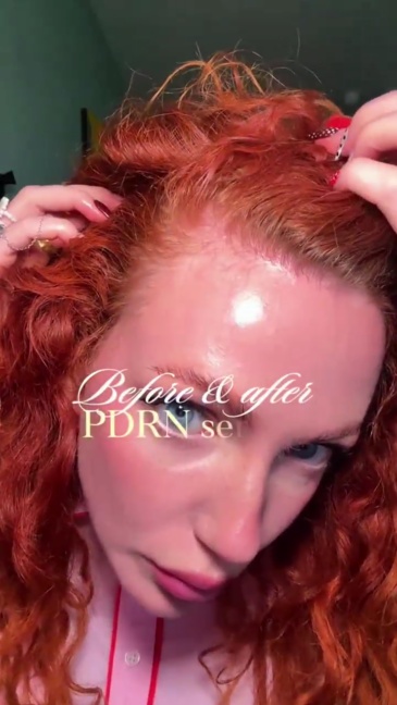 PDRN Hair Ampoule