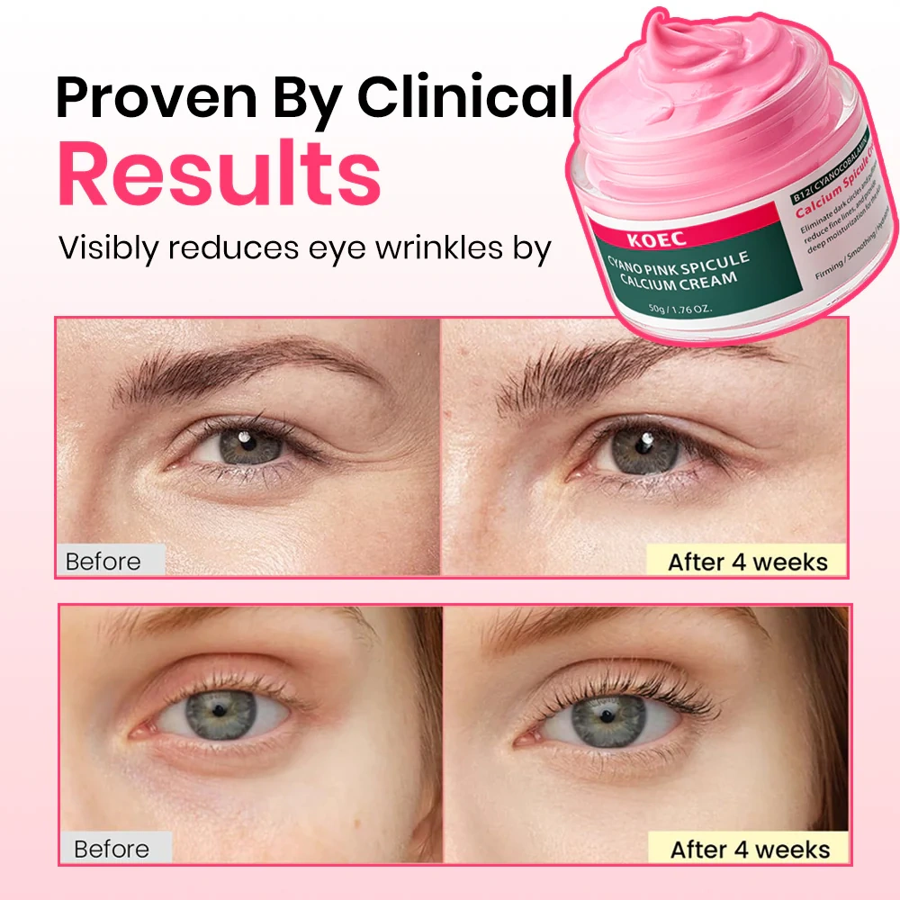 Pink Spicule Calcium Cream