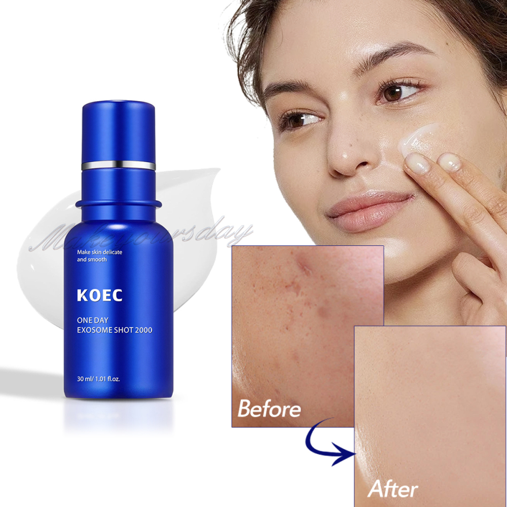 ONE DAY EXOSOME SHOT 2000 Face Serum