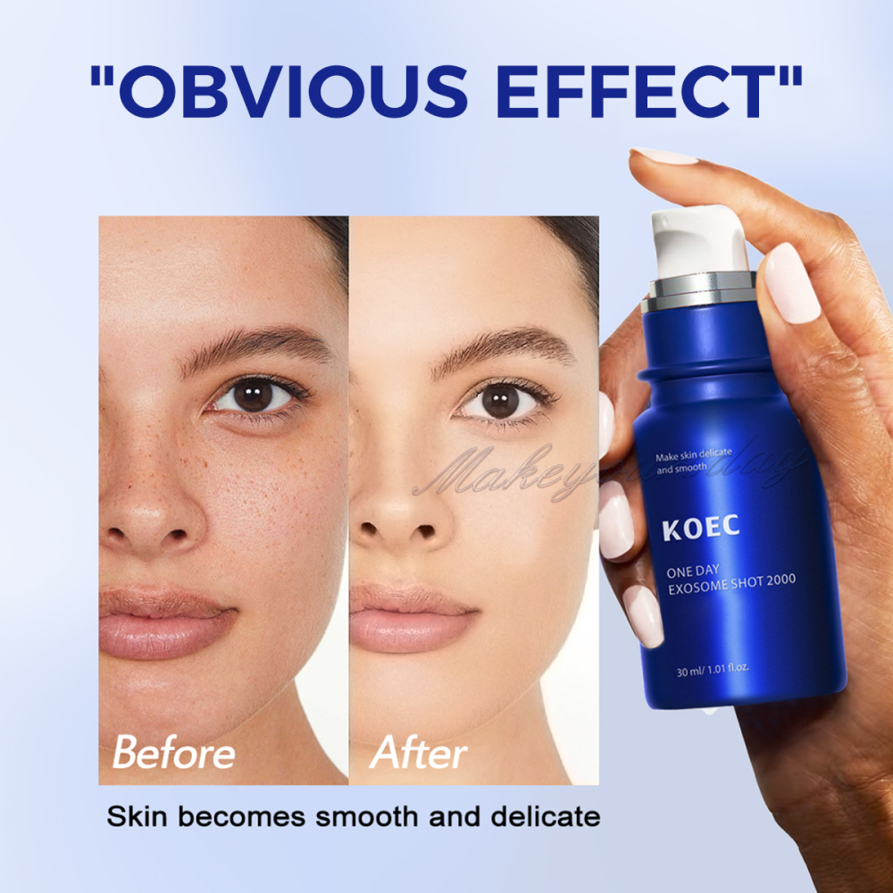 ONE DAY EXOSOME SHOT 2000 Face Serum