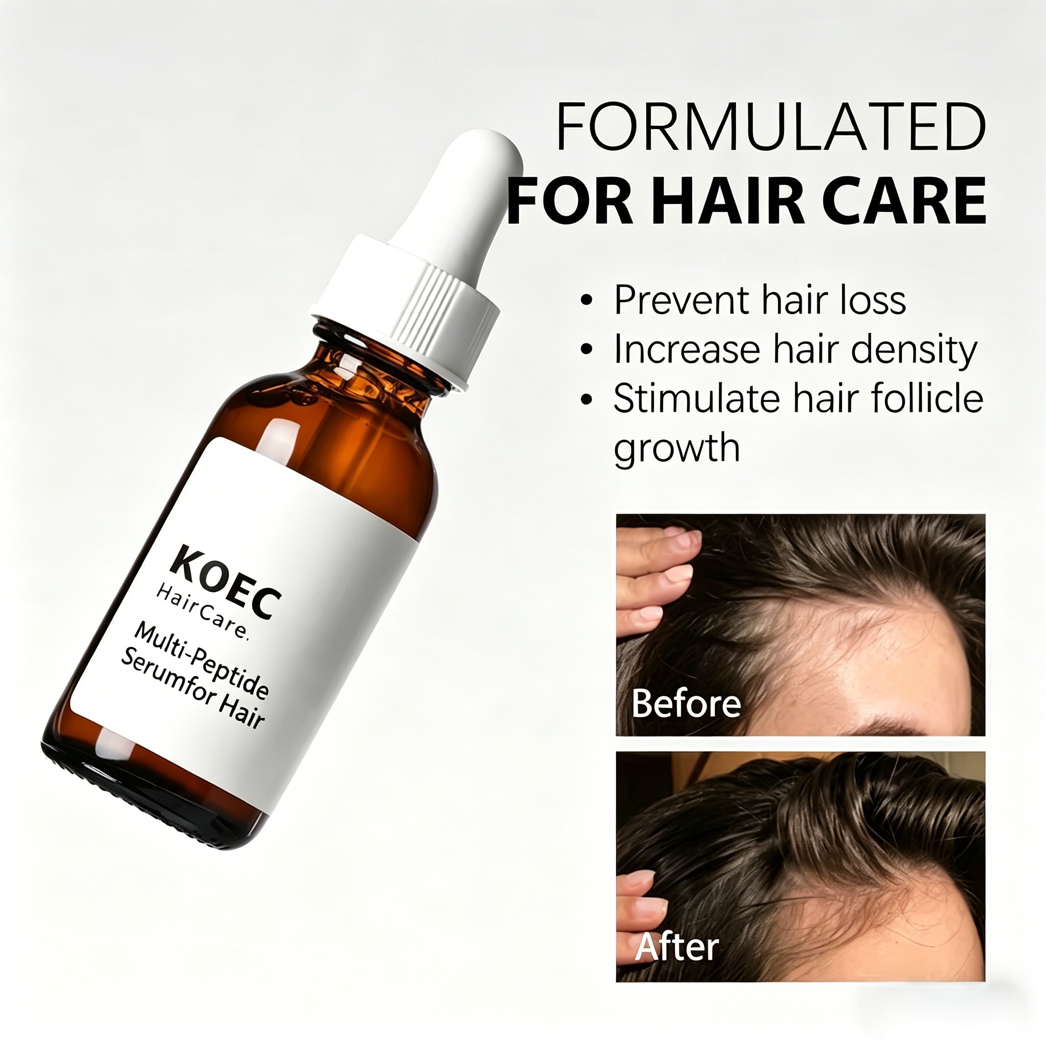 KOEC Multi-Peptide Hair Care Serum, Peptide Hair Growth Serum for Thinning Hair, Strengthen Hair Follicles, Reduce Hair Loss, Nourish Scalp & Boost Thicker Fuller Hair, Hair Regrowth Treatment Oil for Men & Women