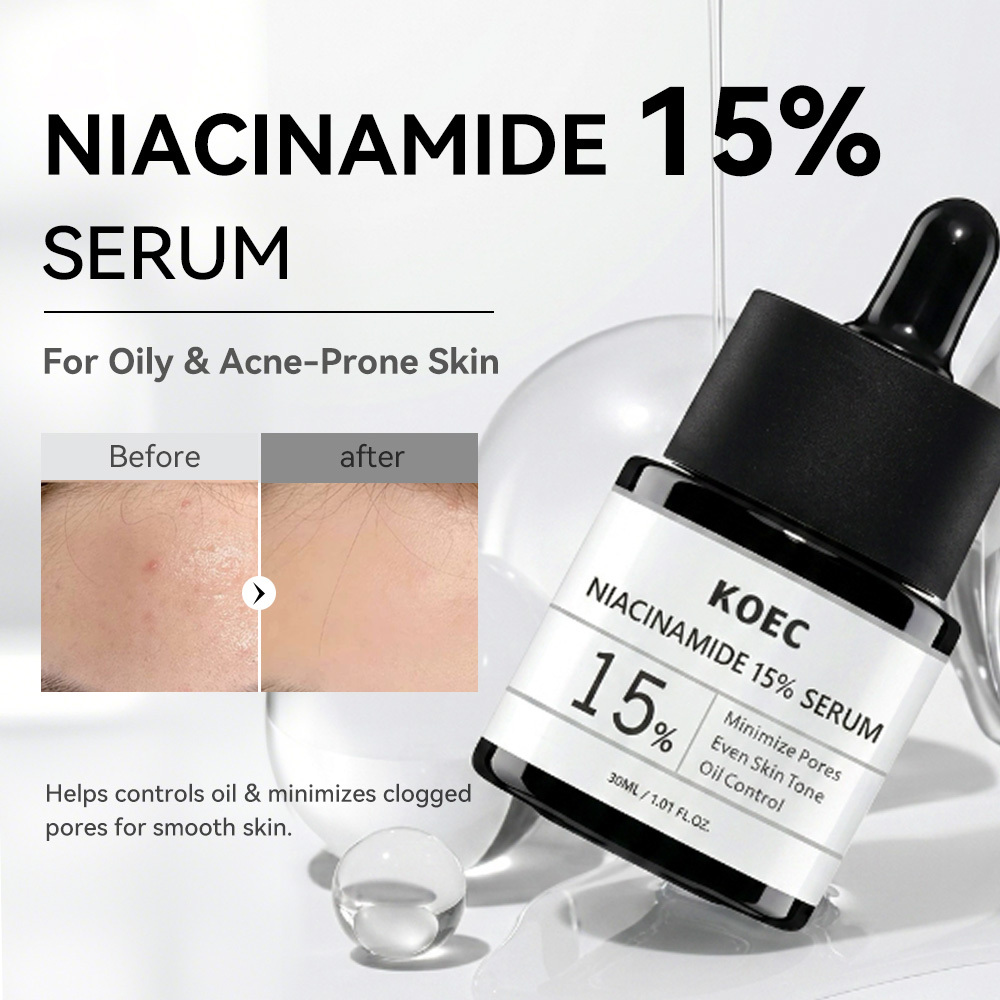 KOEC 15% Niacinamide Serum, Oil Control Pore Minimizing Facial Serum for Uneven Skin Tone, Brightening Balancing Skin Care Serum, 30ml / 1.01 fl.oz