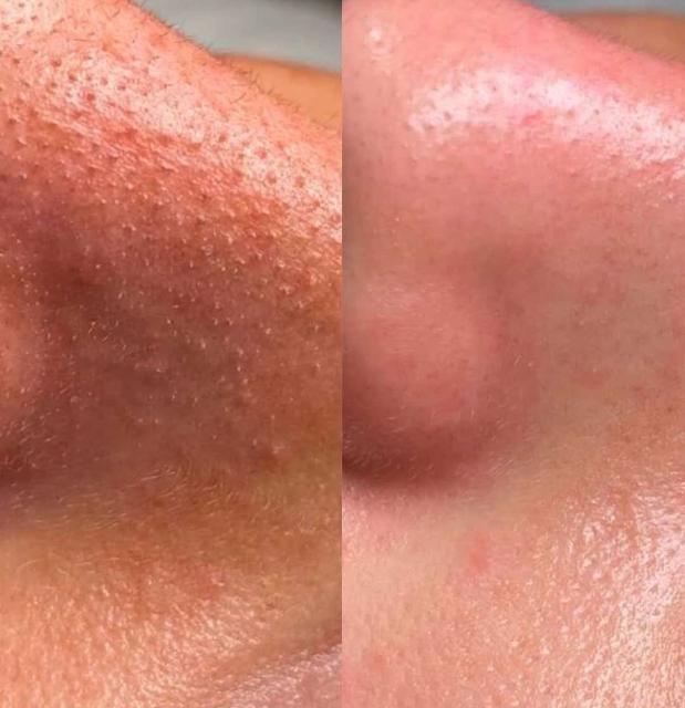 Hydra Skincare  – Machine de soin du visage 9-en-1 professionnelle