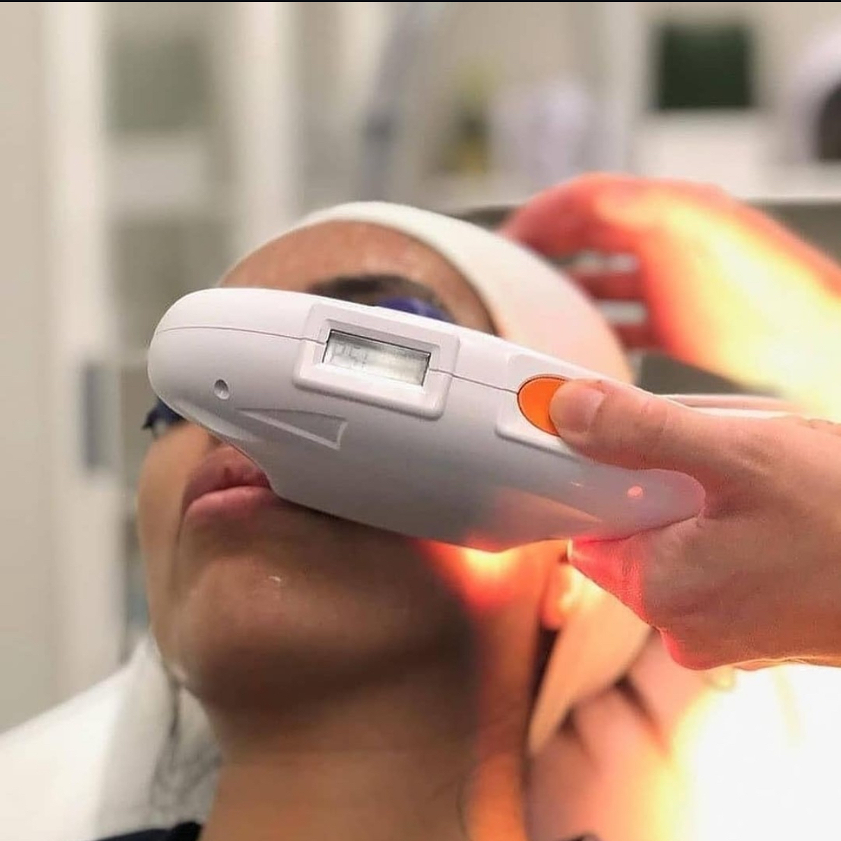 Appareil IPL SHR Professionnel | Épilation Définitive et Rajeunissement Cutané