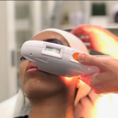 Appareil IPL SHR Professionnel | Épilation Définitive et Rajeunissement Cutané