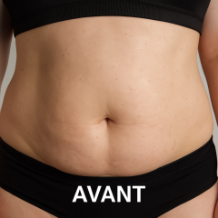 Machine de Cryolipolyse 360° | Système de Minceur Professionnel
