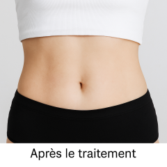 Machine de Cryolipolyse 360° | Système de Minceur Professionnel