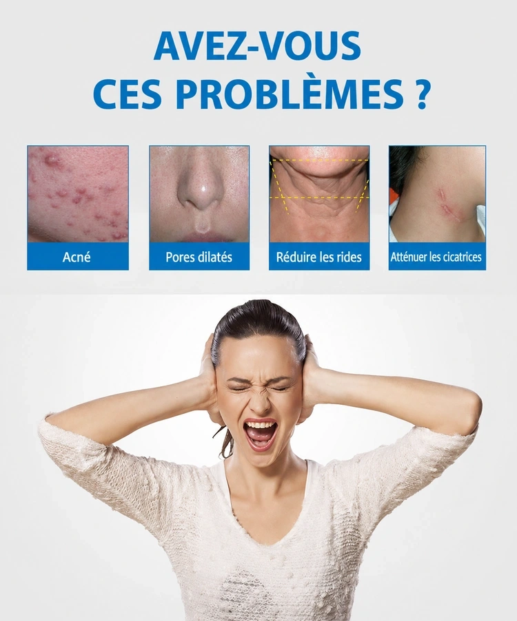 Avez-vous ces problèmes de peau : acné, pores dilatés, rides et cicatrices 