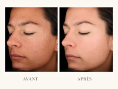Avant après amélioration de la texture de peau, teint plus uniforme, peau plus lisse et plus éclatante.