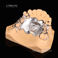 Framework Partial Denture Restorations
