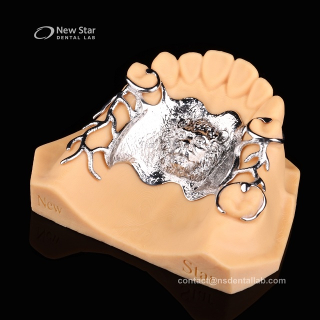 Framework Partial Denture Restorations