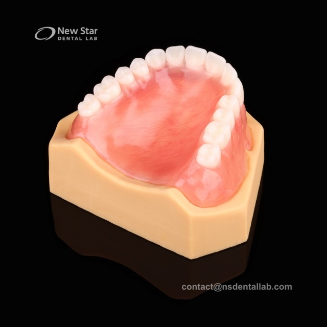 Full Denture Restorations