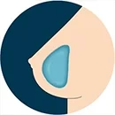 Gel Breasts+$30