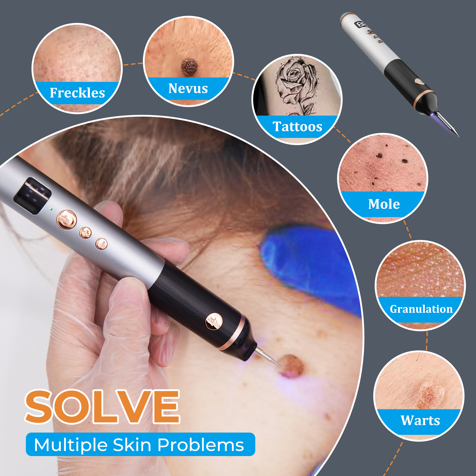 Factory Electric Plasma Pen Skin Mole Removal Facial Wart Label Tattoo Removal Tool