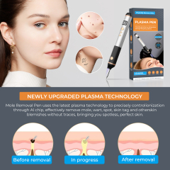 Factory Electric Plasma Pen Skin Mole Removal Facial Wart Label Tattoo Removal Tool