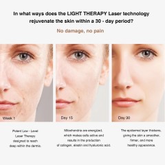 Factory Skin Care Face Led Therapy Red Blue Green Photon Infrared Light Face Massager Acne Treatment Device Laser Eye Surgery
