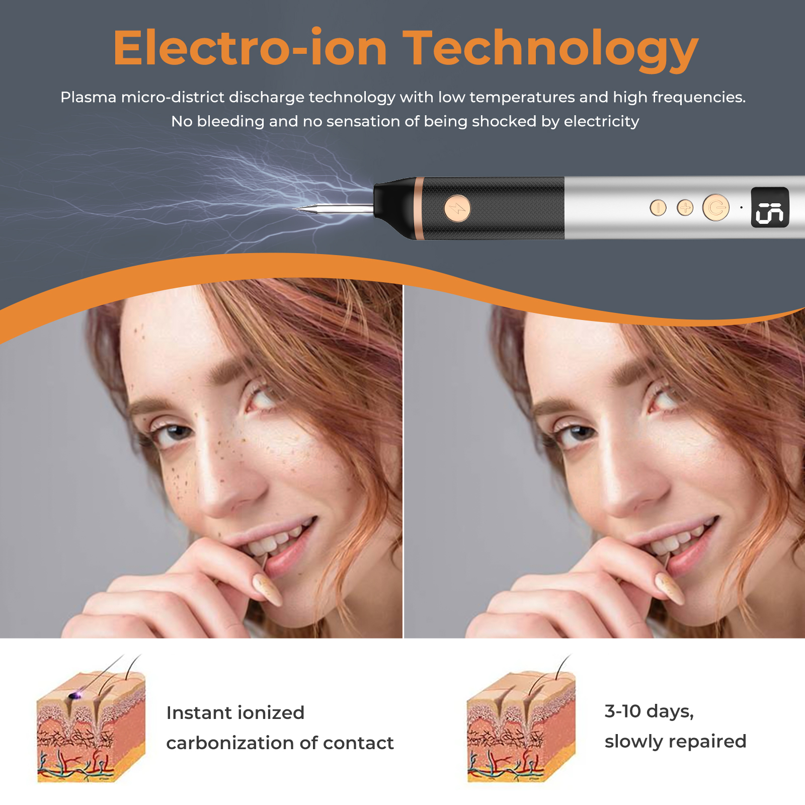Factory Electric Plasma Pen Skin Mole Removal Facial Wart Label Tattoo Removal Tool