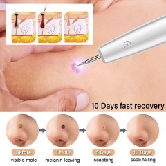 Dark Spot Mole Wart Remover Pen Skin Tag Remover Laser Plasma Pen for Skin Tag Remover
