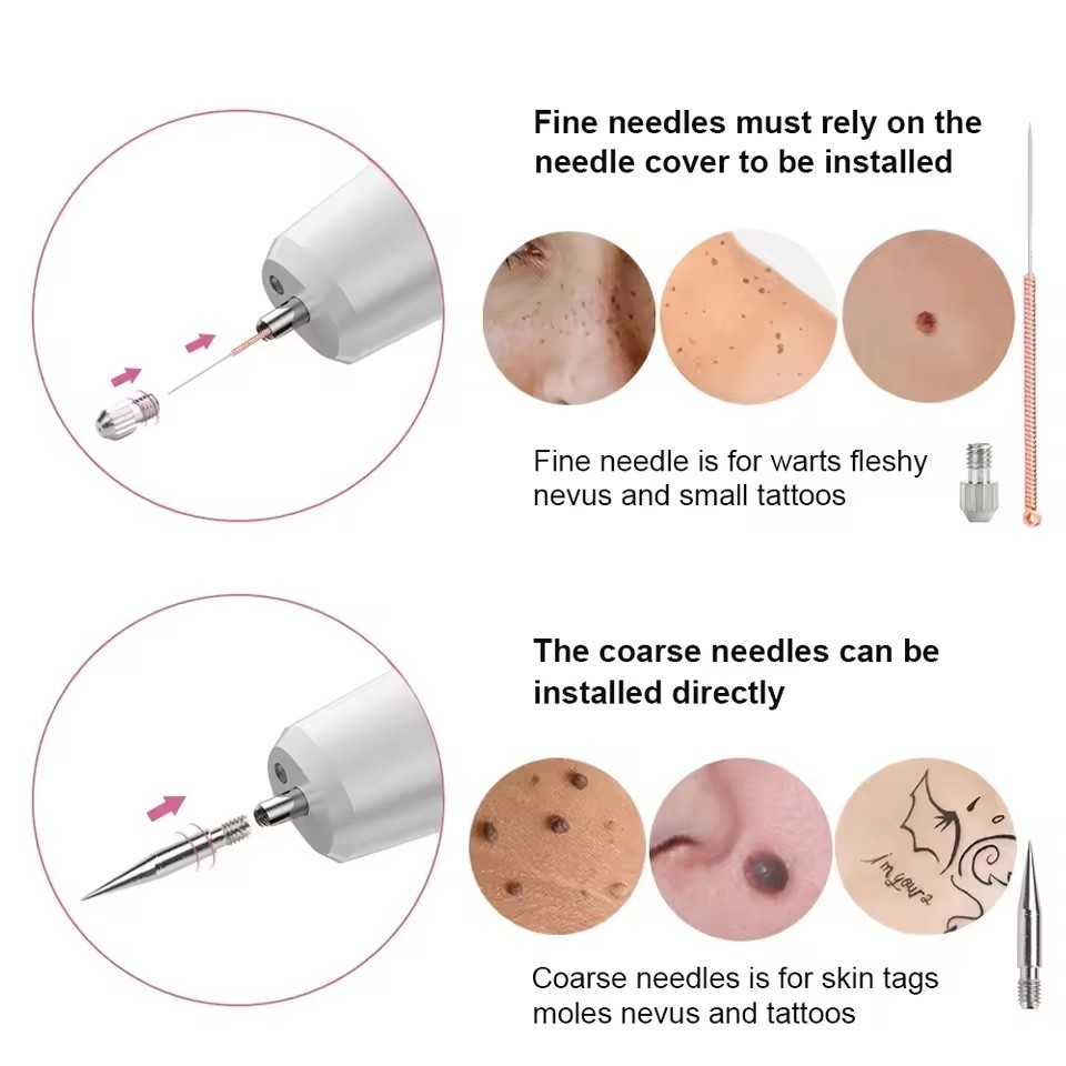 Dark Spot Mole Wart Remover Pen Skin Tag Remover Laser Plasma Pen for Skin Tag Remover