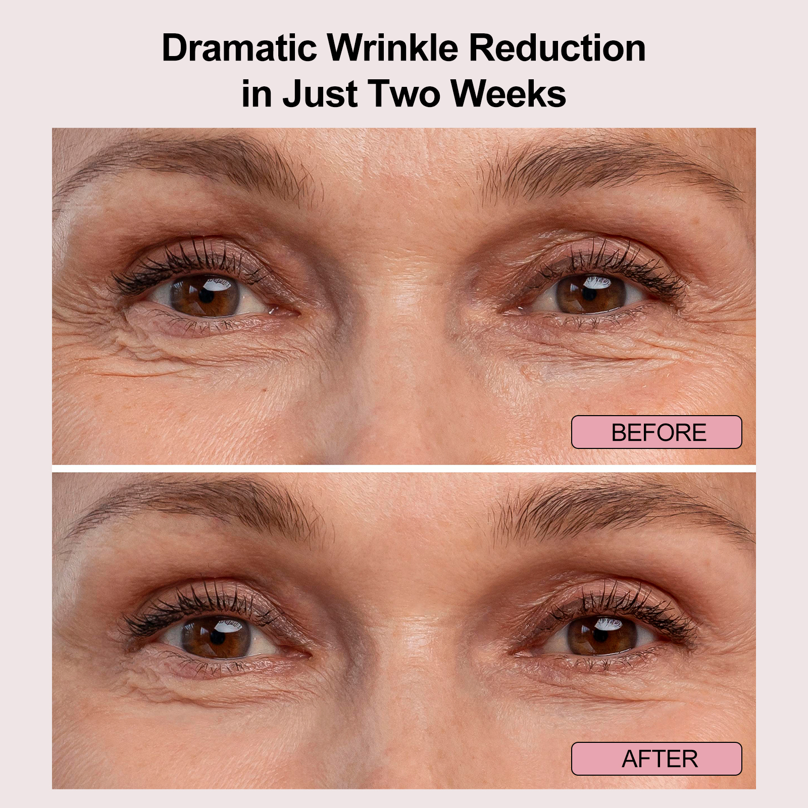 Beauty Skin Care Near Infrared Red Light Therapy LED Eye Bags Remover Mask Device