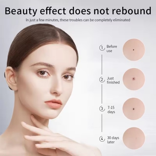 15 Levels of Intelligent Adjustment Beauty Spot Scanning Pen Professional Mole Removal