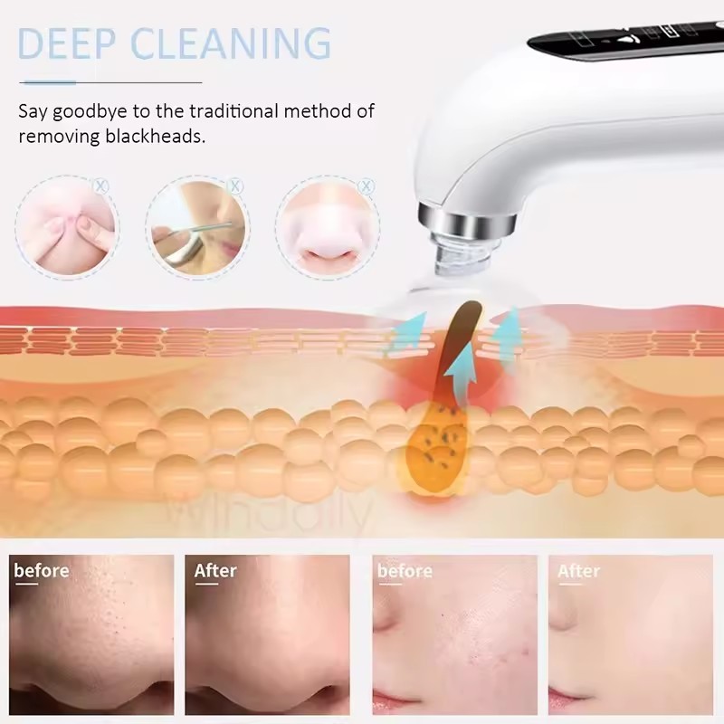 Black Head Remover Pore Vacuum Cleaner Electric Micro Small Bubble Facial Cleasing Machine USB Rechargeable Beauty Device