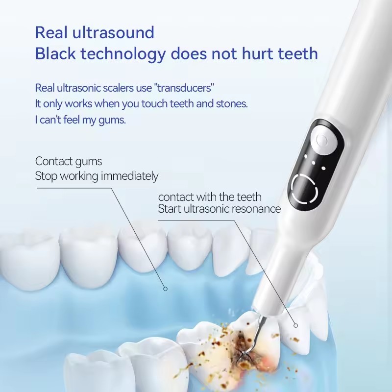 Ultrasonic Tooth Cleaner Household Oral Calculus Remover Tartar Remover with LED Lighting