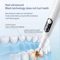 Ultrasonic Tooth Cleaner Household Oral Calculus Remover Tartar Remover with LED Lighting