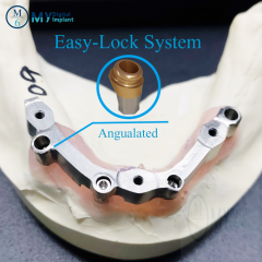 locator Easy-implant overdenture abutment attachment : Removable, support bar practice