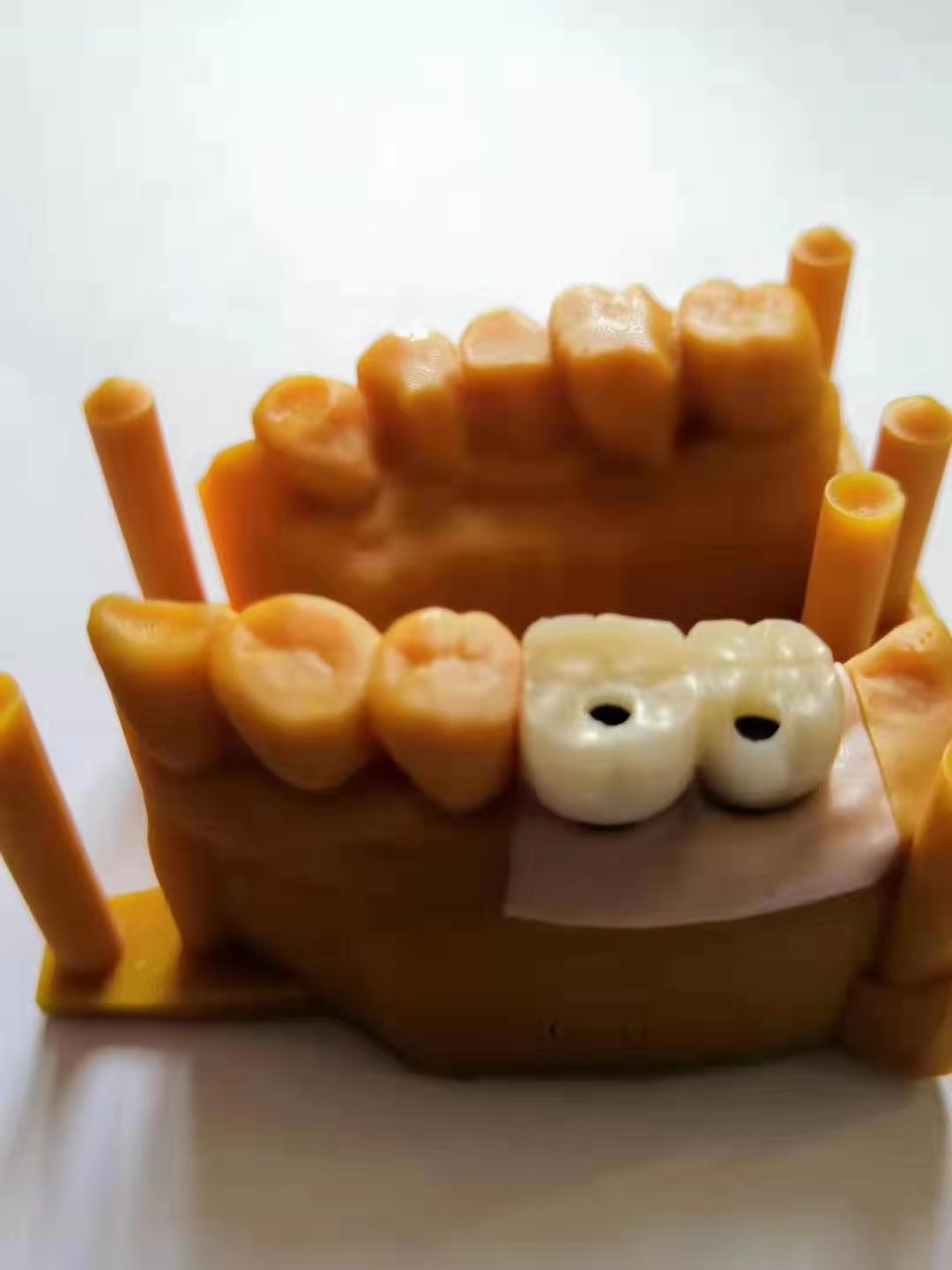 CADCAM Crown