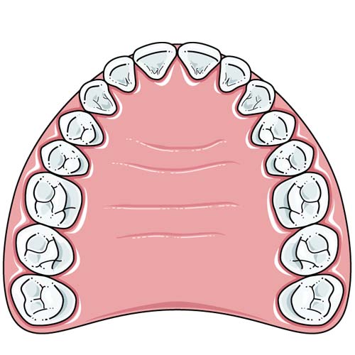according to the tooth width,choose the right diameter of a MUA