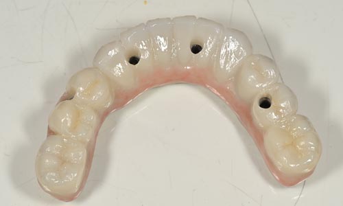 CAM manufacture the final restoration 2