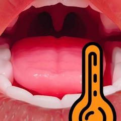 Oral Heating +(USD89)
