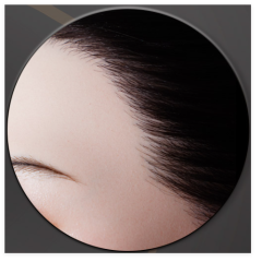 Implanted Synthetic Hair+(USD199)